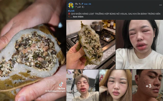 Пирог с яйцами муравьев стал «хитом» в сети: некоторые попадают в больницу из-за аллергии, кому следует его избегать?